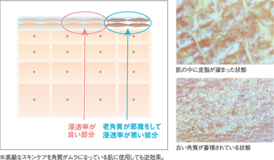 古い角質は老化やトラブル肌の原因