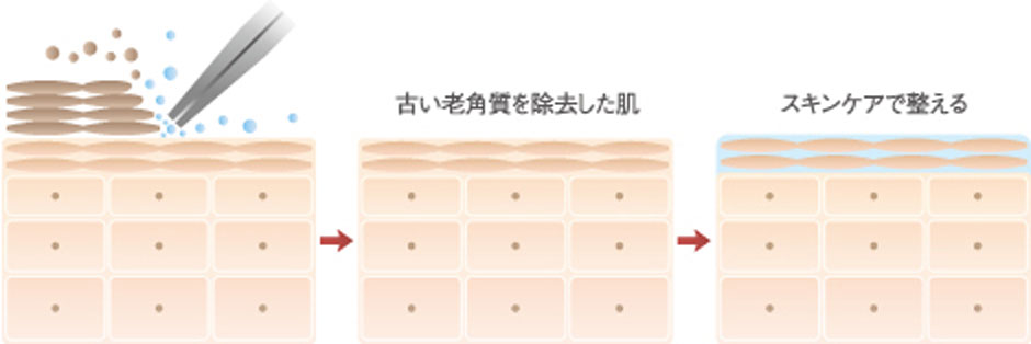 キメを整え、肌のくすみを取る